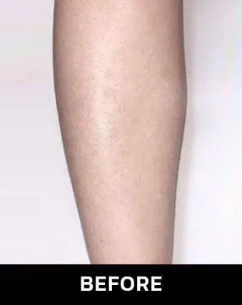 img02