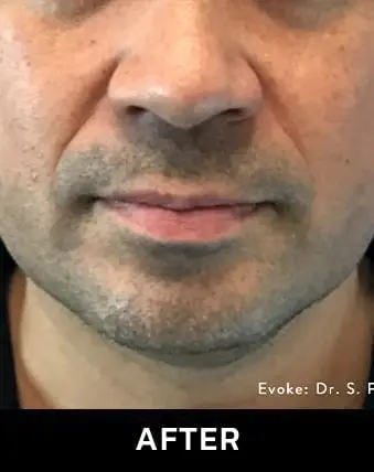 EAFTER2-min EAFTER2-min