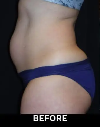 mcf (3)