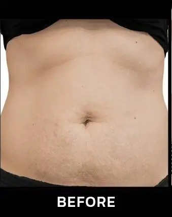 mcf (18)