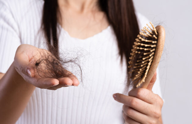 Hair Loss Treatment