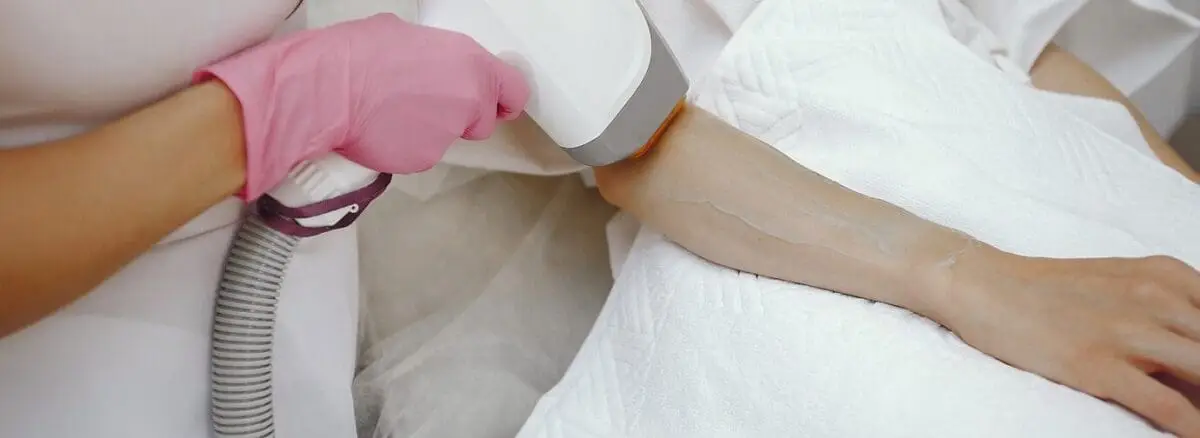 Laser Hair Removal in Calgary